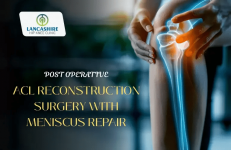 Post Operative - ACL Reconstruction Surgery with Meniscus Repair.png