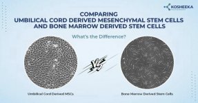 Umbilical Cord-Derived Mesenchymal Stem Cells.jpg