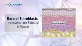 Dermal Fibroblasts.jpg