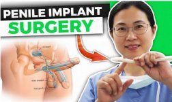 penile implant surgery.jpg