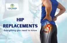 Hip replacements Everything you need to know 1.png