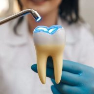 dentalfilling